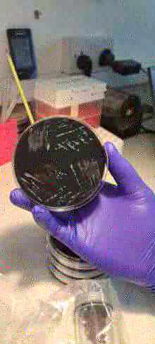Culture plate being examined during early CCC laboratory work in The Gambia