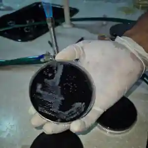 Gloved hand holding a culture plate during laboratory work in Nigeria